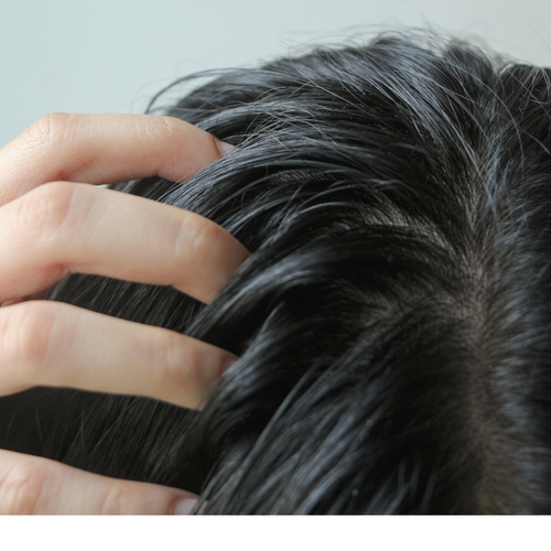 Se débarrasser des Cheveux Gras : Le Guide complet